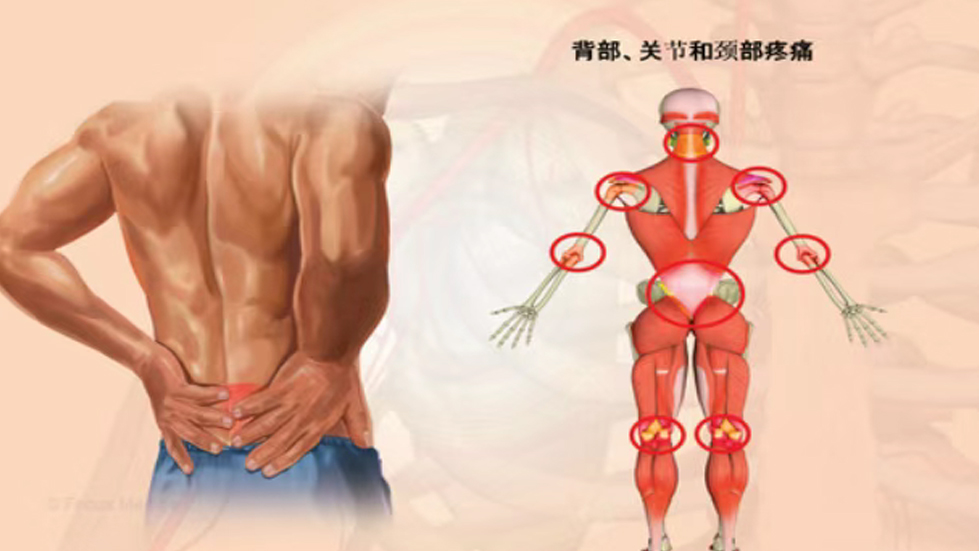 太原市第七人民医院康复医学科门诊特色手法技术介绍——意大利筋膜手法