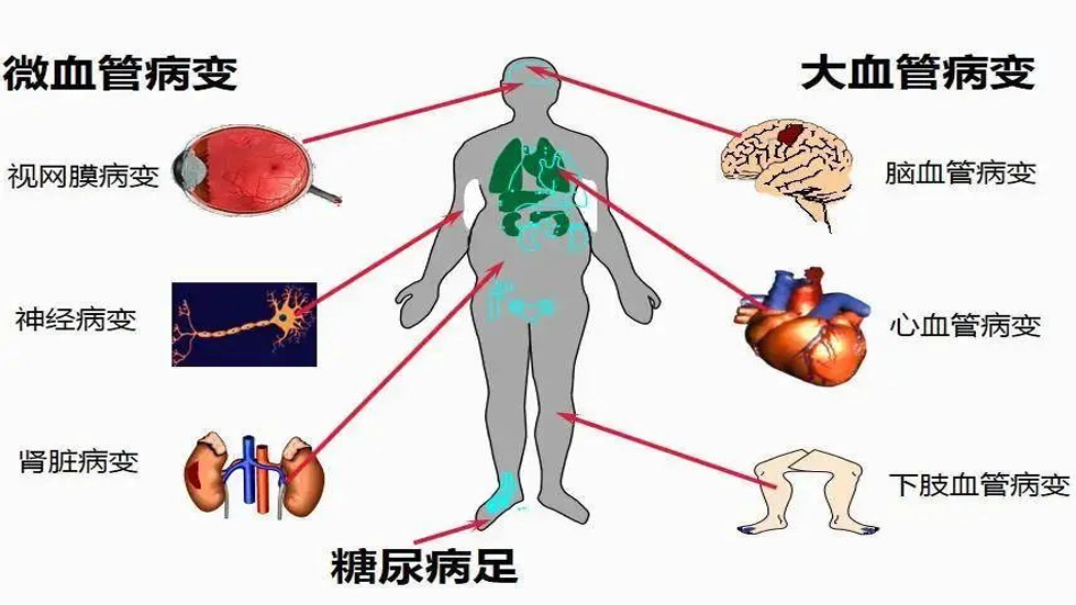 【医院动态】联合国糖尿病日|糖尿病与幸福感