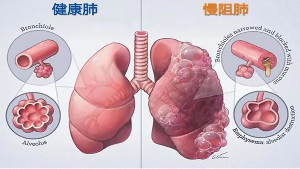 【医院动态】了解你的肺功能