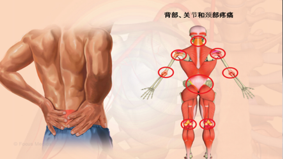 太原市第七人民医院康复医学科门诊特色手法技术介绍——意大利筋膜手法