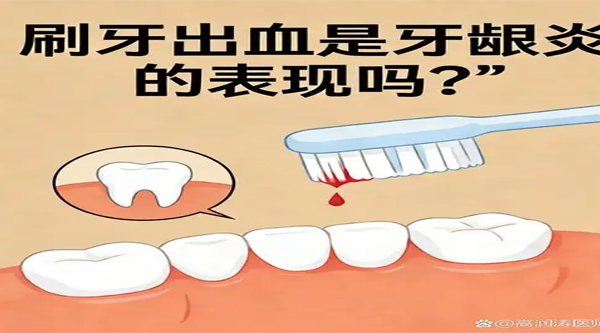 牙龈出血要停止刷牙或用牙线， 等待“自愈”……是真是假？| 谣言终结站